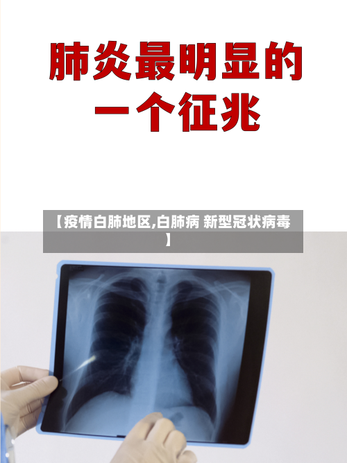 【疫情白肺地区,白肺病 新型冠状病毒】-第2张图片