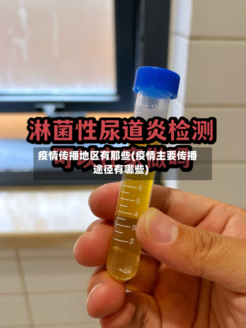 疫情传播地区有那些(疫情主要传播途径有哪些)