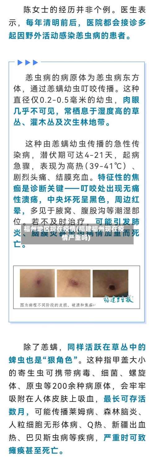 福州地区现在疫情(福建福州现在疫情严重吗)-第2张图片
